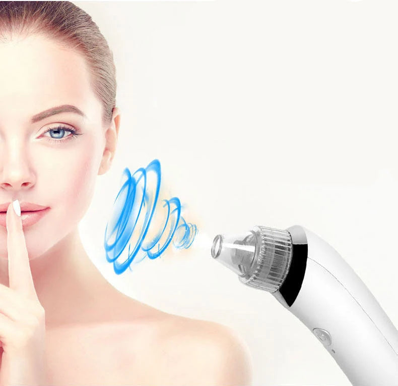 Facial Pore Cleaner Vacuum Suction & Microdermabrasion USB Rechargeable