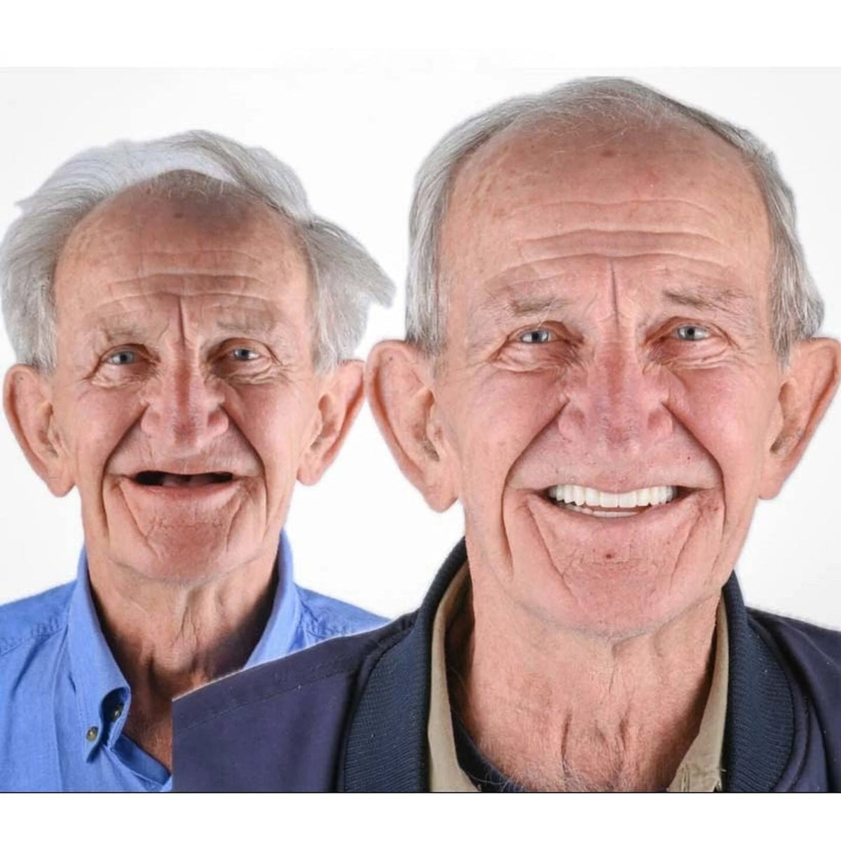 Full Arch Denture Set Flexible Cushion Grip Upper and Lower
