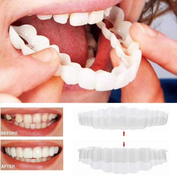 Removable Veneers Ultra-Thin Acrylic Individual Fit Kit
