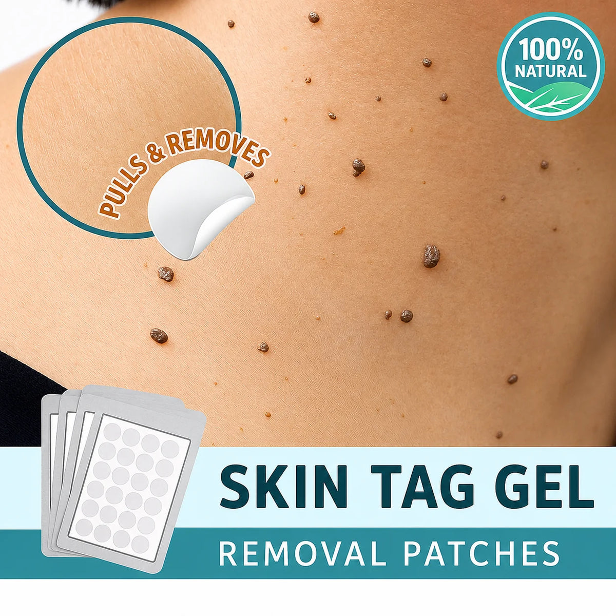 Skin Tag Removal Patches Pain-Free & Non-Invasive Skin-Friendly