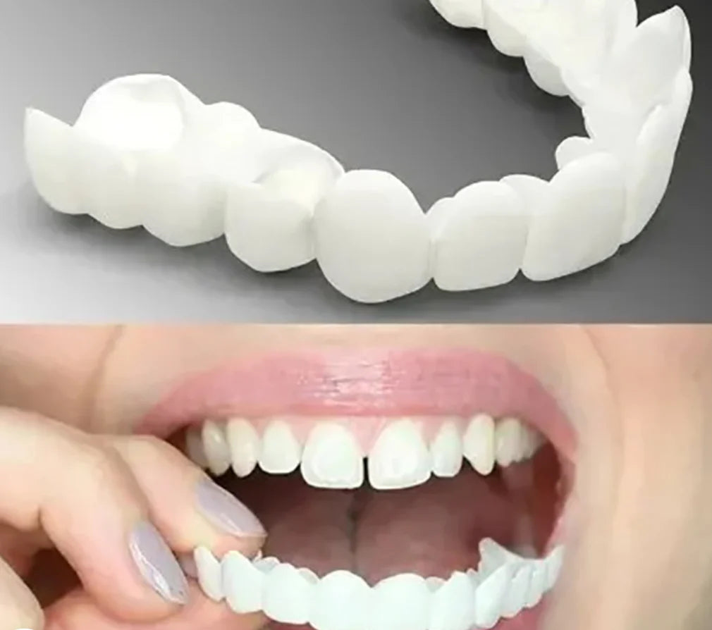 Snap-On Dentures Flexible Fit Natural Shade No Adhesive