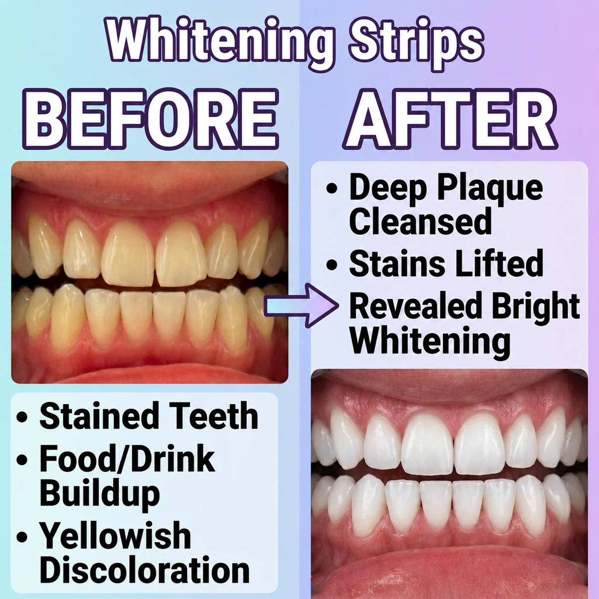 Teeth Whitening Strips Flexible Fit 30-Min Application 14 Pieces
