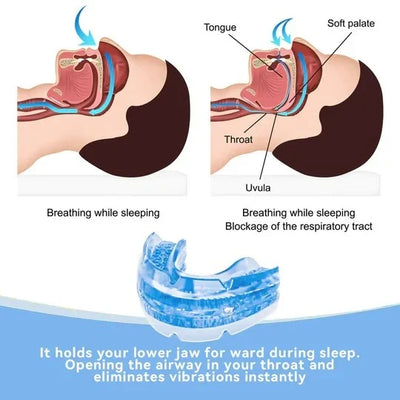 Anti-Snoring Mouthpiece Adjustable Reusable Washable