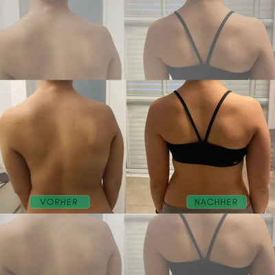 Back & Shoulder Posture Corrector X-Shaped Adjustable Low-Profile