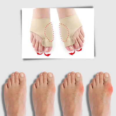 Bunion Corrector Gel Toe Separator & Side Cushion