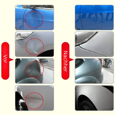 Dent Repair Kit Paint-Safe Stainless Steel Puller 18 Tabs