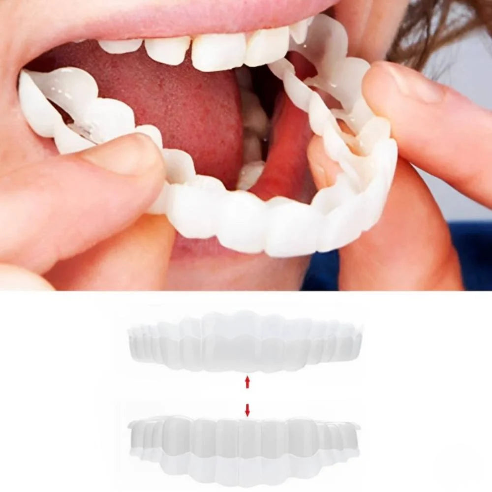 Dental Veneers Clip-On Upper & Lower Set with Silicone Fit