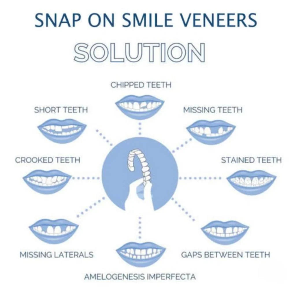 Dental Veneers Clip-On Upper & Lower Set with Silicone Fit