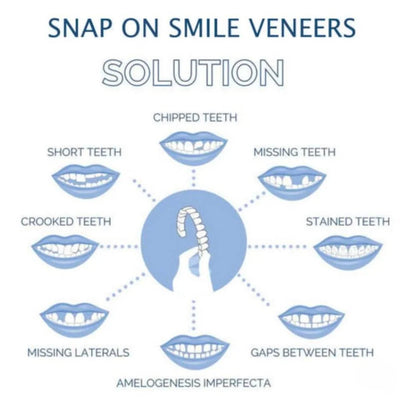 Dental Veneers Clip-On Upper & Lower Set with Silicone Fit