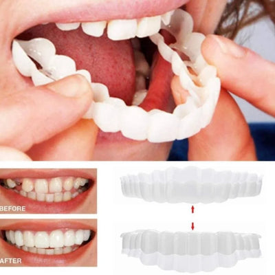 Dental Veneers Clip-On Upper & Lower Set with Silicone Fit
