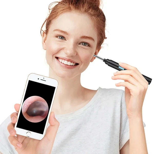 Ear Camera 20x Magnification & Wireless App