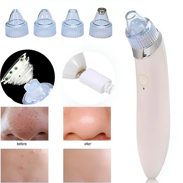 Facial Pore Cleaner Vacuum Suction & Microdermabrasion USB Rechargeable