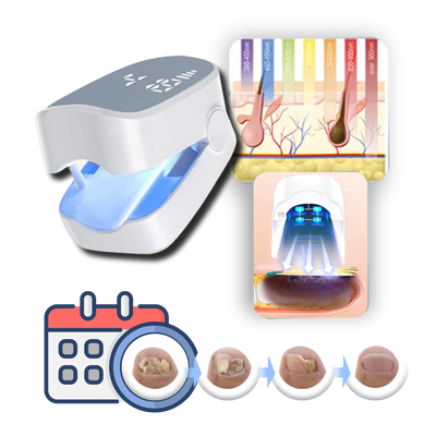Nail Treatment Device Dual Cold Laser & Blue Light