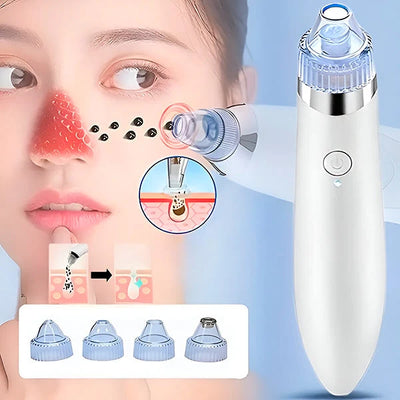 Pore Cleaner 2-In-1 Vacuum & Microdermabrasion USB Rechargeable