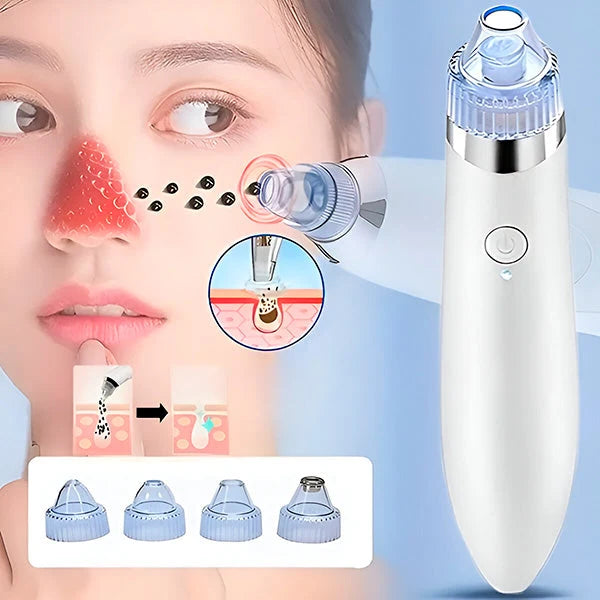 Pore Cleaner 2-In-1 Vacuum & Microdermabrasion USB Rechargeable