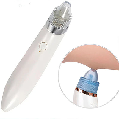 Pore Cleaner 2-In-1 Vacuum & Microdermabrasion USB Rechargeable