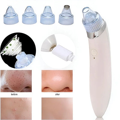 Pore Cleaner 2-In-1 Vacuum & Microdermabrasion USB Rechargeable