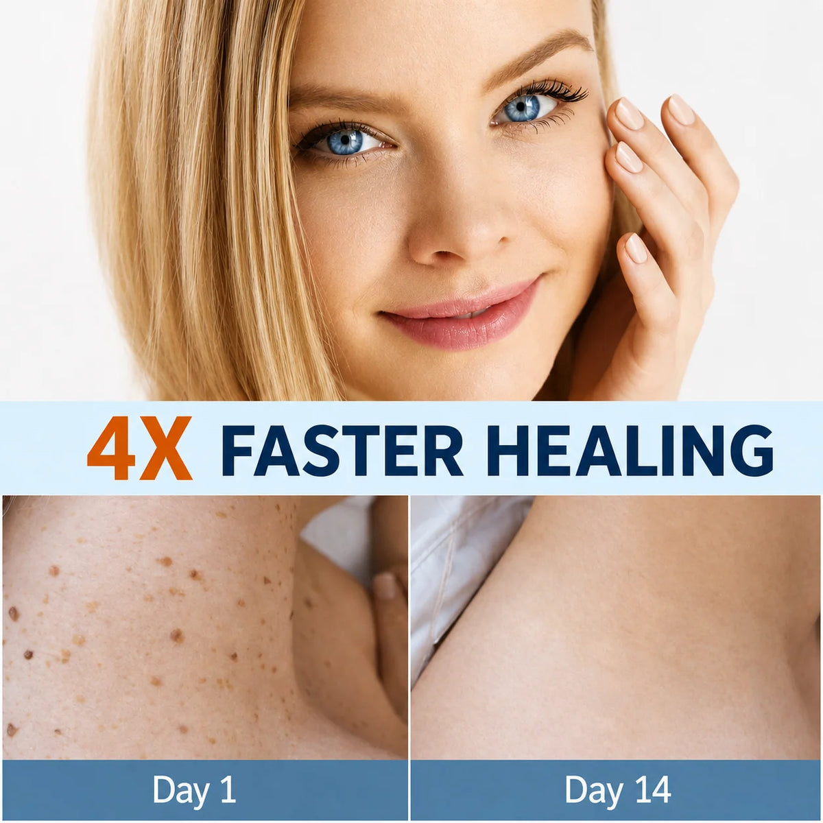 Skin Tag Removal Patches Gentle & Discreet for Daily Wear