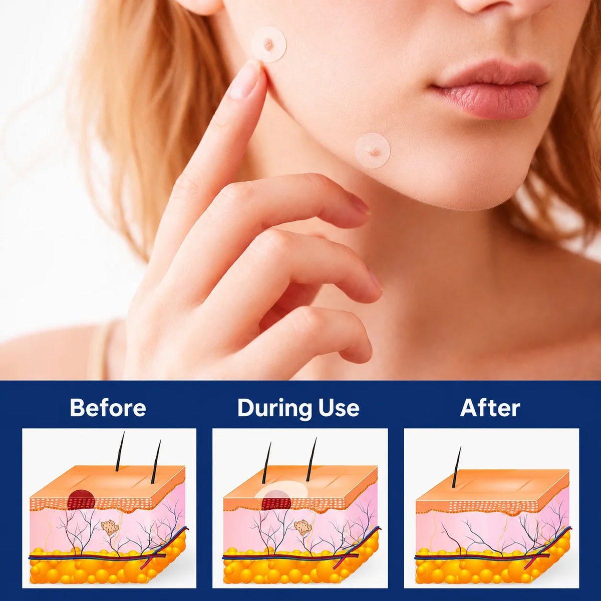 Skin Tag Removal Patches Pain-Free & Non-Invasive Skin-Friendly