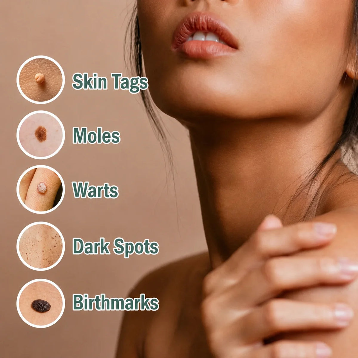 Skin Tag Remover Precision Pen Face & Body
