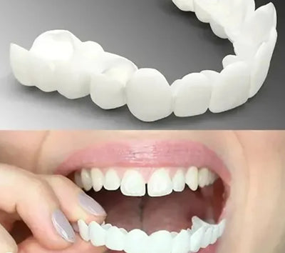Snap-On Dentures Flexible Fit Natural Shade No Adhesive