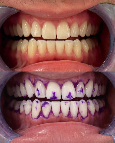 Teeth Whitening Strips Flexible Fit 30-Min Application 14 Pieces