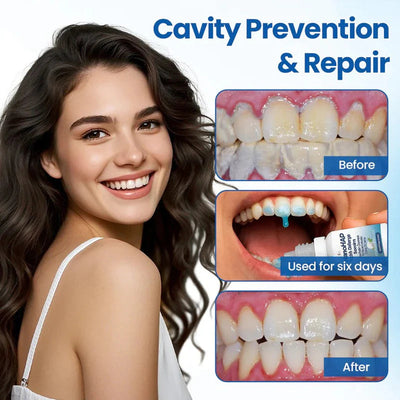 Tooth Serum Remineralizing Nano-HAP Sensitivity Relief Mint Flavor
