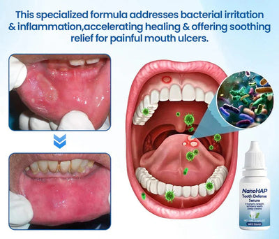 Tooth Serum Remineralizing Nano-HAP Sensitivity Relief Mint Flavor