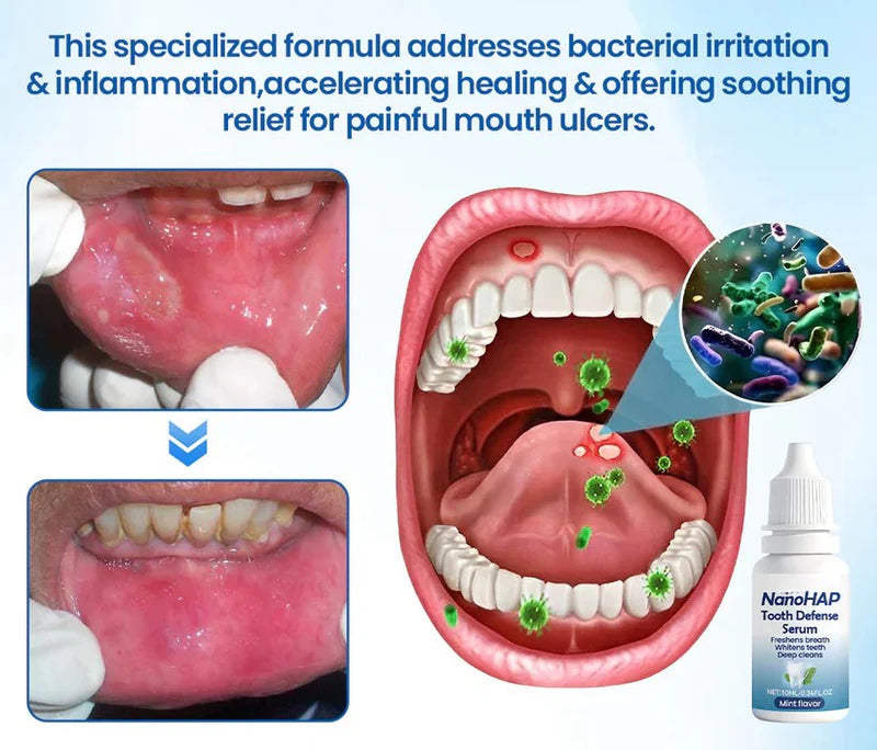 Tooth Serum Remineralizing Nano-HAP Sensitivity Relief Mint Flavor
