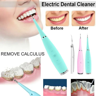 Ultrasonic Dental Cleaner Metal Head 12,000 Vibrations/Min