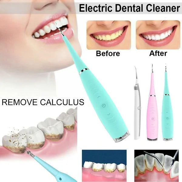 Ultrasonic Tooth Cleaner Metal Alloy Head & 12,000 VPM