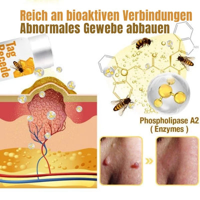 Wart Remover Spray Pain-Free Bee Venom Inspired 20ml